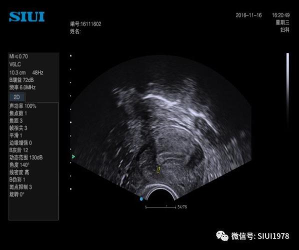 已婚型外音是什么意思