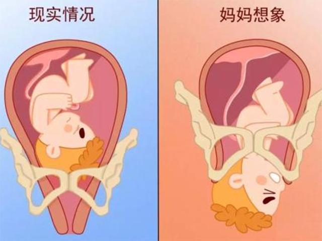 孩子入盆是什么感觉